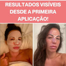 CollagenGlow® - Máscara Facial de Colágeno
